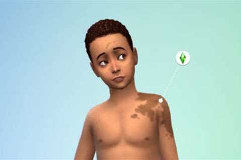 Sims 4 Is Adding Stretch Marks, Birthmarks, and C-Section Scars In Next Free Update